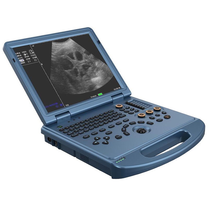 VC-U6 Portable Color Doppler Ultrasound Scanner