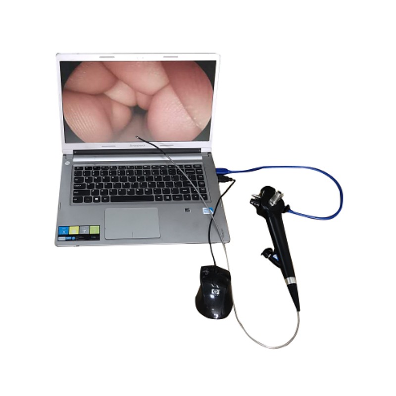 VED-GBS3 Video Ureteroscope